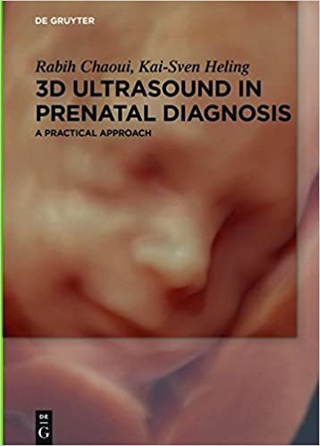 3D Ultrasound in Prenatal Diagnosis A Practical Approach