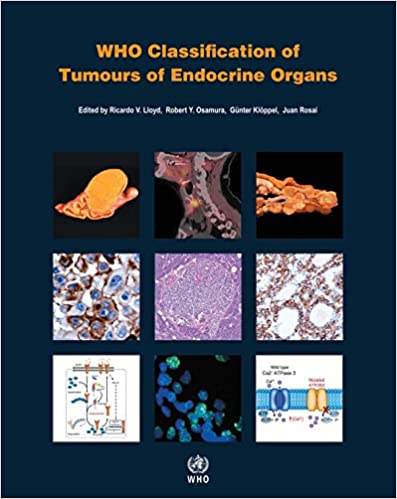 WHO Classification of Tumours of Endocrine Organs 4th Edition