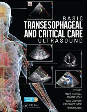 Basic Transesophageal and Critical Care Ultrasound