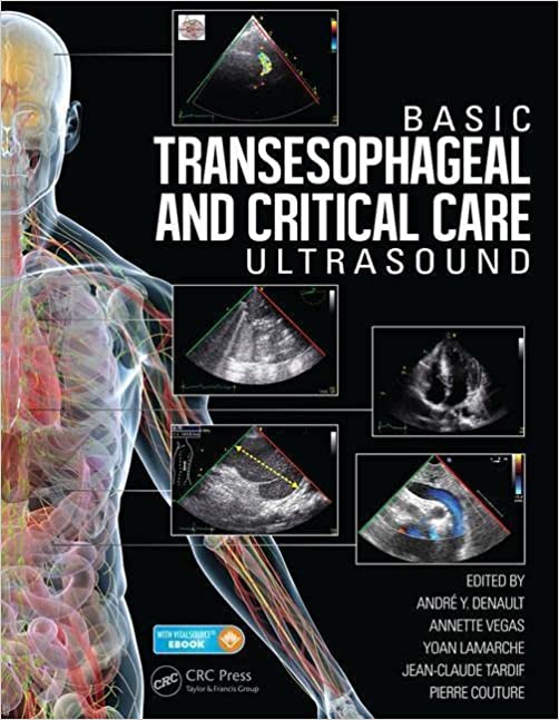 Basic Transesophageal and Critical Care Ultrasound