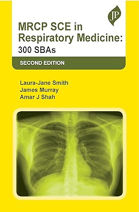 MRCP SCE in Respiratory Medicine 300 SBAs 2nd Edition