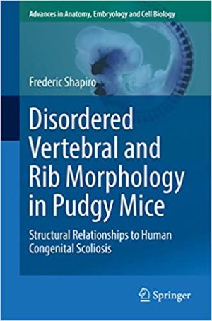 Disordered Vertebral and Rib Morphology in Pudgy Mice Structural Relationships to Human Congenital Scoliosis