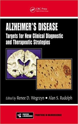 Alzheimers Disease Targets for New Clinical Diagnostic and Therapeutic Strategies