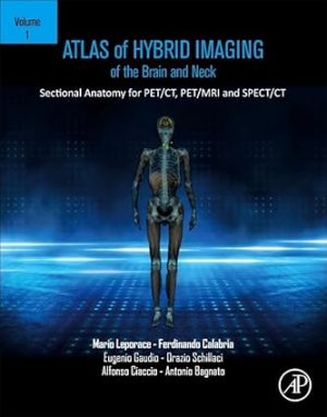 Atlas of Hybrid Imaging Sectional Anatomy for PET CT PET MRI and SPECT CT Volume 1 Brain and Neck Sectional Anatomy for PET CT PET MRI and SPECT CT