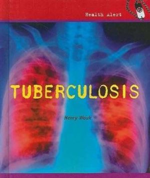 Tuberculosis By Henry Wouk