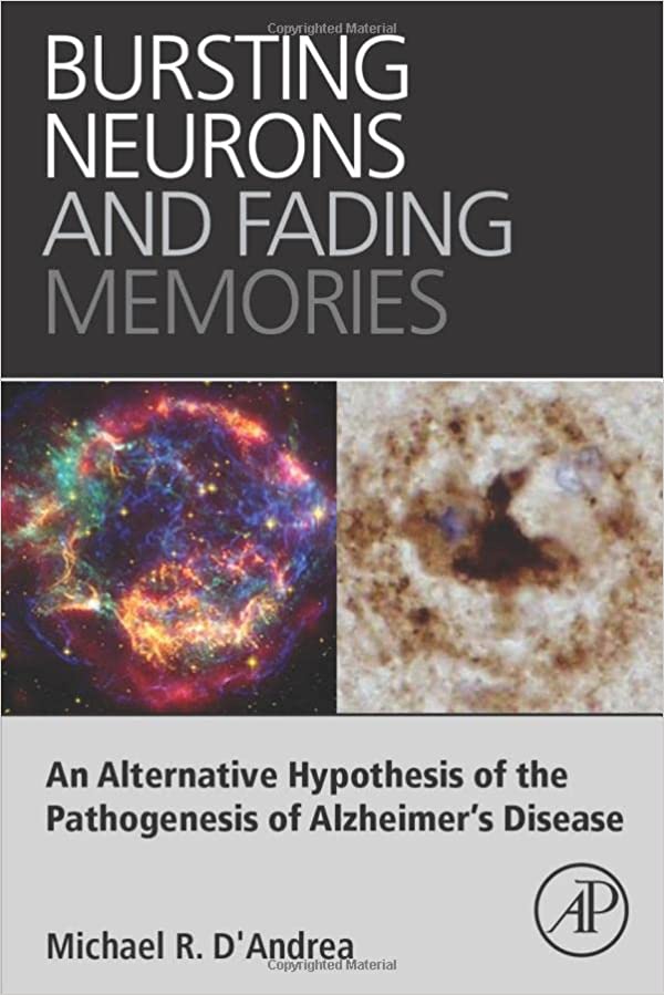 Bursting Neurons and Fading Memories An Alternative Hypothesis of the Pathogenesis of Alzheimers Disease
