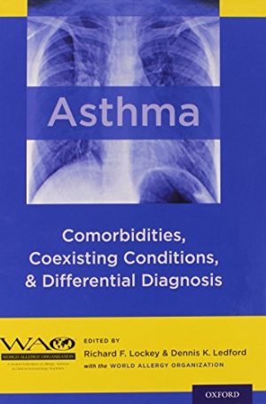Asthma Comorbidities Coexisting Conditions And Differential Diagnosis