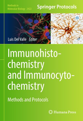 Immunohistochemistry and Immunocytochemistry Methods and Protocols