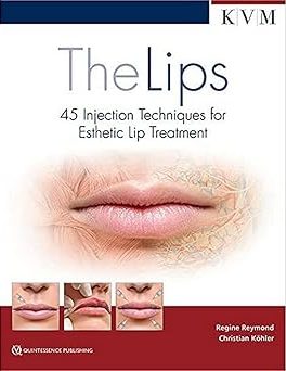 The Lips 45 Injection Techniques for Esthetic Lip Treatment