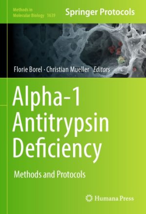 Alpha 1 Antitrypsin Deficiency Methods and Protocols