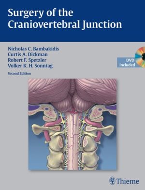 Surgery of the Craniovertebral Junction 2nd Edition
