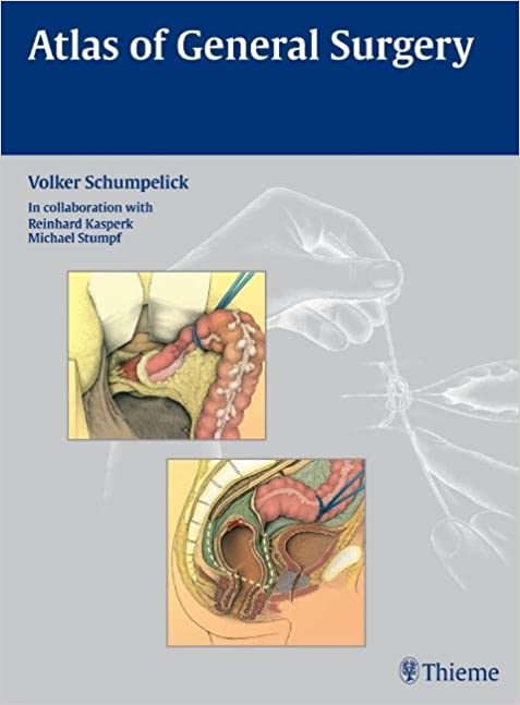 Atlas of General Surgery By Volker Schumpelick