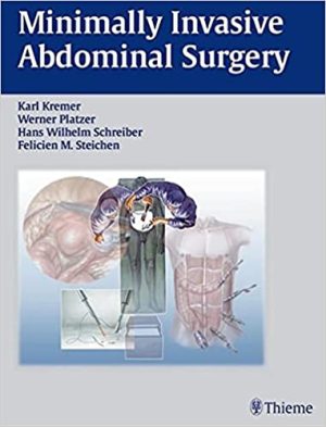 Minimally Invasive Abdominal Surgery Laparascopic and Thoracic Surgery