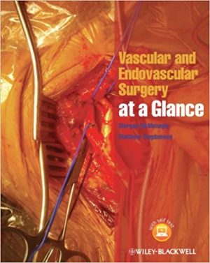Vascular And Endovascular Surgery At A Glance