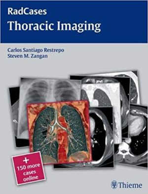 Radcases Thoracic Imaging