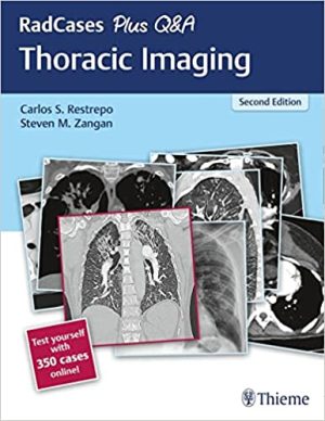 RadCases Plus Q&A Thoracic Imaging 2nd Edition