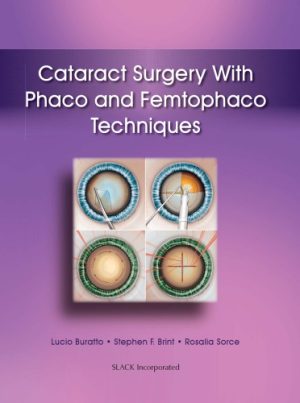 Cataract Surgery With Phaco and Femtophaco Techniques