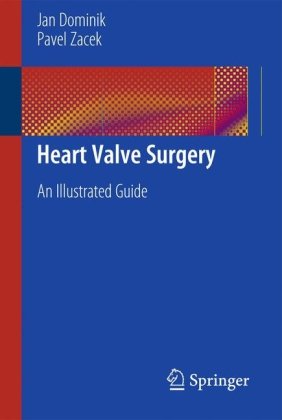 Heart Valve Surgery An Illustrated Guide