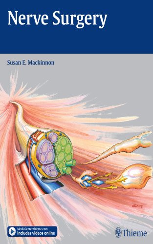 Nerve Surgery by Susan E Mackinnon
