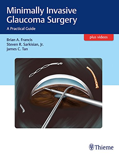 Minimally Invasive Glaucoma Surgery A Practical Guide