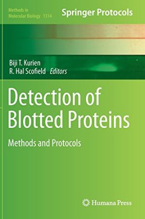 Detection of Blotted Proteins Methods and Protocols