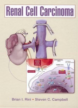 Renal Cell Carcinoma By Brian I Rini
