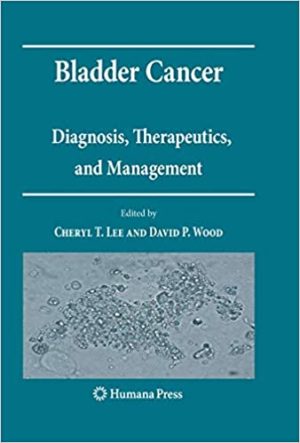 Bladder Cancer Diagnosis Therapeutics and Management