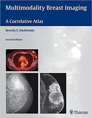 Multimodality Breast Imaging A Correlative Atlas 2nd Ed