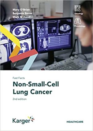 Fast Facts Non Small Cell Lung Cancer 2nd Edition