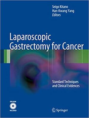 Laparoscopic Gastrectomy for Cancer Standard Techniques and Clinical Evidences