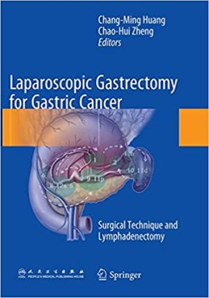 Laparoscopic Gastrectomy for Gastric Cancer Surgical Technique and Lymphadenectomy