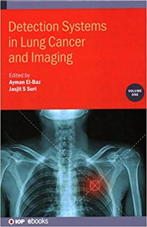 Detection Systems in Lung Cancer and Imaging Volume 1