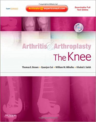 Arthritis and Arthroplasty The Knee