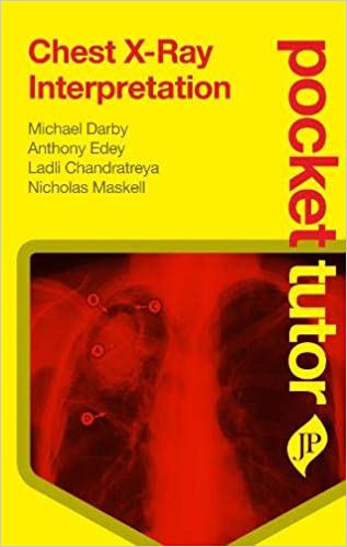 Pocket Tutor Chest XRay Interpretation