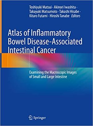 Atlas of Inflammatory Bowel Disease Associated Intestinal Cancer Examining the Macroscopic Images of Small and Large Intestine