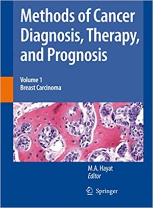 Methods of Cancer Diagnosis Therapy and Prognosis Volume 1 Breast Carcinoma