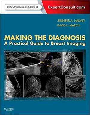 Making the Diagnosis A Practical Guide to Breast Imaging