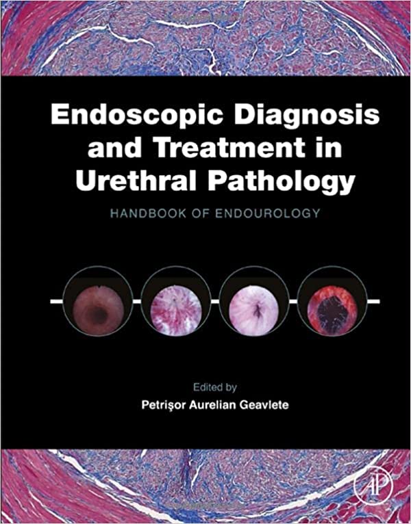 Endoscopic Diagnosis and Treatment in Urethral Pathology Handbook of Endourology