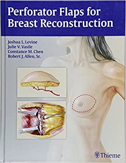 Perforator Flaps for Breast Reconstruction