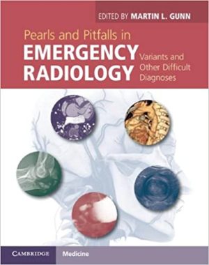 Pearls and Pitfalls in Emergency Radiology Variants and Other Difficult Diagnoses