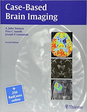 Case Based Brain Imaging 2nd Ed