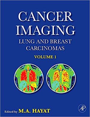 Cancer Imaging Lung and Breast Carcinomas