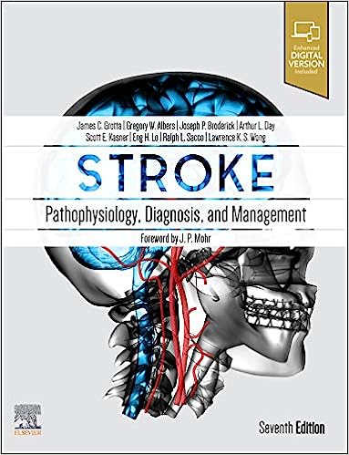 Stroke Pathophysiology Diagnosis and Management