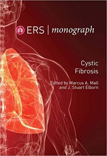 Cystic Fibrosis By Marcus A Mall
