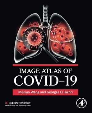 Image Atlas of COVID 19