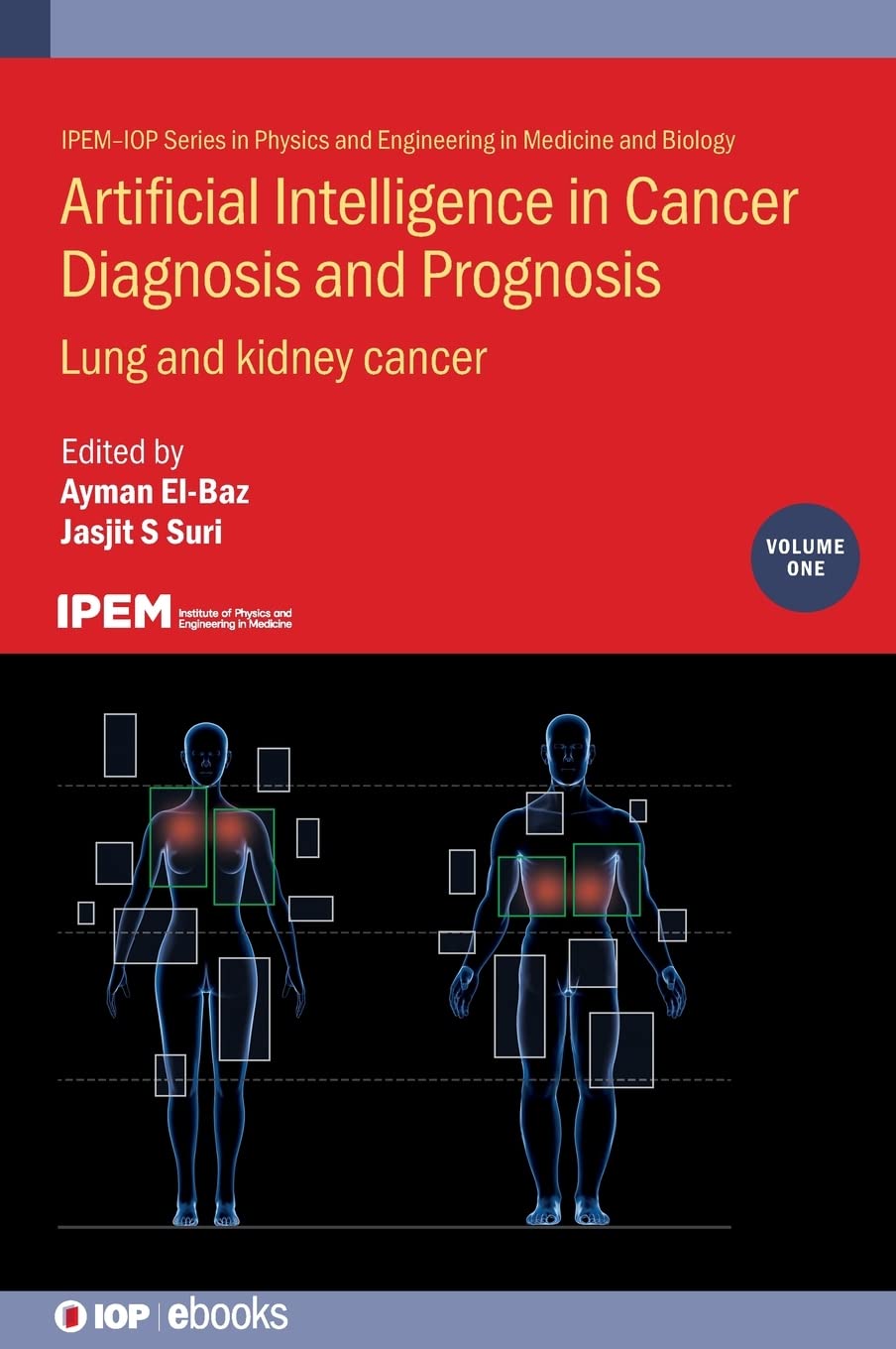 Artificial Intelligence in Cancer Diagnosis and Prognosis Volume 1 Lung and kidney cancer