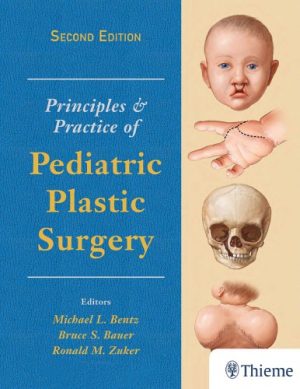 Principles and Practice of Pediatric Plastic Surgery 2nd Edition