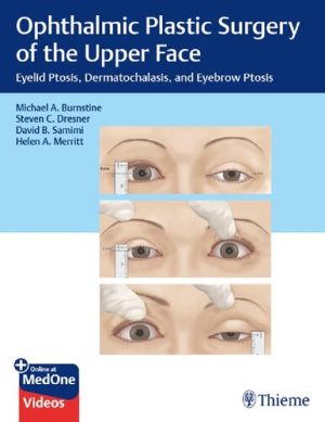 Ophthalmic Plastic Surgery of the Upper Face Eyelid Ptosis Dermatochalasis and Eyebrow Ptosis