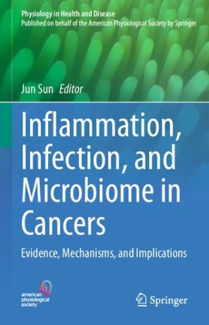 Inflammation Infection and Microbiome in Cancers Evidence Mechanisms and Implications