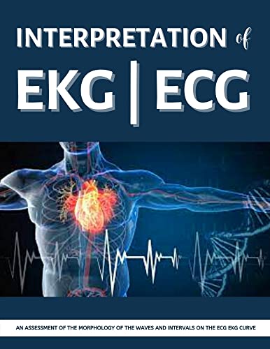 Interpretation Of EKG ECG